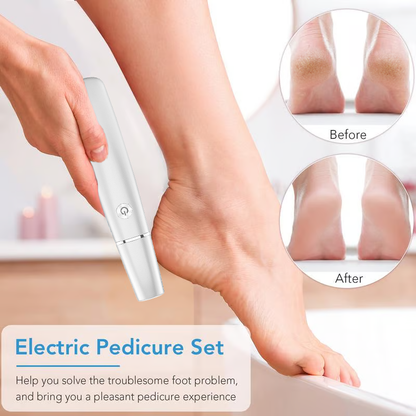 🌸LIMITED SALE : ONLY ￡7.99!!🌸Electric Feet Callus Remover