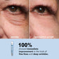 💜Last Day-Buy 1 Get 1 Free!🎁Rapid Reduction Serum ✨Instant Skin Firming & Lifting