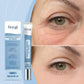 💜Last Day-Buy 1 Get 1 Free!🎁Rapid Reduction Serum ✨Instant Skin Firming & Lifting