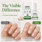 ⚡💅Last Day Special Price ￡7.99✨Garlic Nail Polish for Strengthening Brittle Damaged Nails